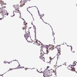 SPSB2 Antibody, Novus Biologicals:Antibodies:Primary Antibodies